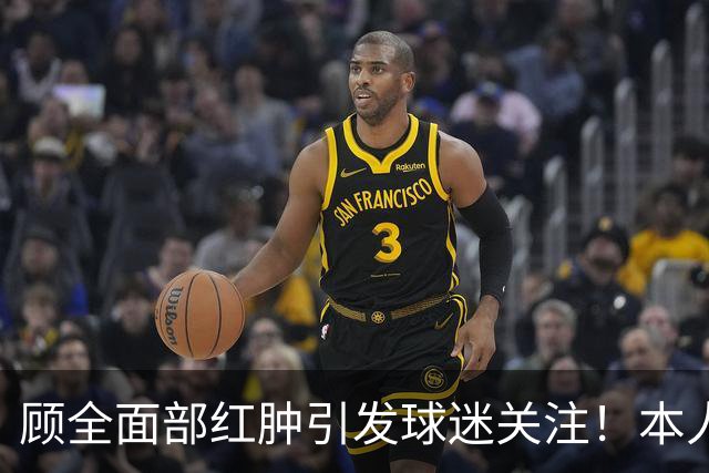 顾全面部红肿引发球迷关注！本人解释是多年皮肤问题并非外伤伤疤